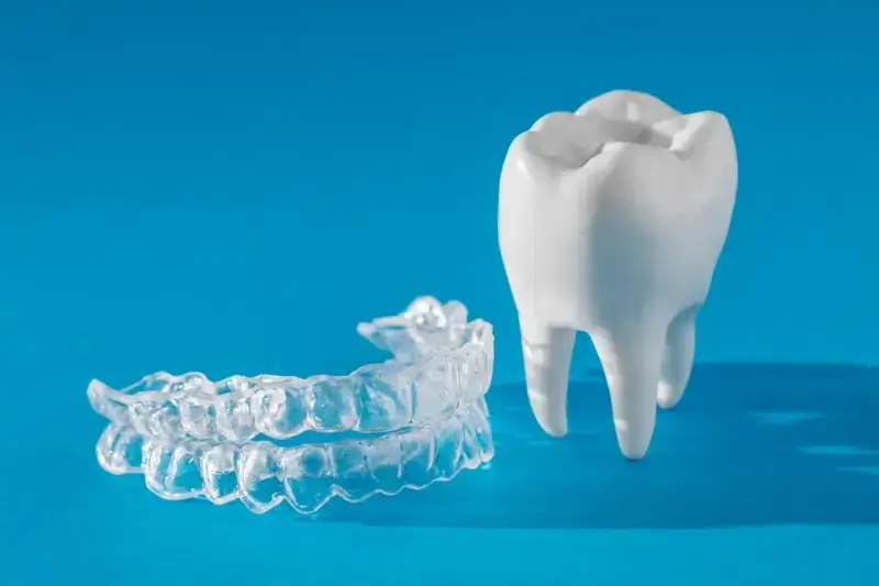 Ile kosztują nakładki Invisalign?